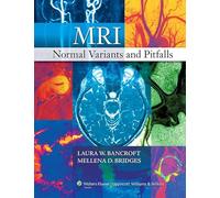 MRI Normal Variants and Pitfalls
