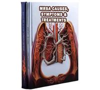 MRSA Causes, Symptoms & Treatments: Get informed about MRSA, its origins, symptoms, and available treatment options to combat this antibiotic-resistant infection.