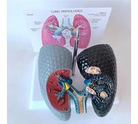 MTTXY Human Lung Model, Smoking Lung and Healthy Lung Model, Visceral Respiratory Pathology Comparison Demonstration for classroom teaching