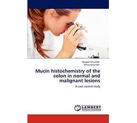 Mucin histochemistry of the colon in normal and malignant lesions: A case control study