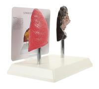 MUCKLILY Lung Anatomy Model Comparison Set, Normal and Smoking Lungs, Pathological Respiratory Model for Medical Education and Teaching