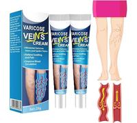 Mucopolysaccharide Polysulfate Cream,Varicose Veins Cream,Legs Care Cream,Varicose Veins Treatment for Legs Pain Relief Spider Soothing,Improve Blood Circulation Soothe Swelling (2pcs)