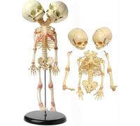 Multi Functions Skeleton Model 37cm/14.5inch Semi-Flexible PVC Double Head Fetal Skeleton Bones Anatomy Model Deformity Double Head Human Fetus Skull Skeleton Anaical Model Educational Use Only