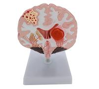 Multi-Purpose Human Anatomical Structure Model Detachable 4.33'' X 7.48'' X 7.48'' with Displaying Stand Anatomy Model for Neuroscience Learning Life Size