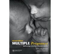 Multiple Pregnancy : Epidemiology, Gestation, and Perinatal Outcome