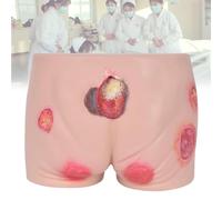 Multiple Simulated Ulcer Wounds, Elderly Decubitus Sore Training Model, Buttock Bedsores Wound Module, Pressure Ulcer Wound Model, Simulated Silicone Buttock Model, for Primary Healthcare Institutions