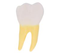 MUSISALY Denture Teeth Model Molar Model Pvc Tooth Specimen Lightweight Demonstration Easy to Use Yellow for Clinics Teaching by Medical Students and Teachers