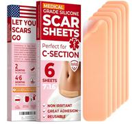 MYHELP VISIBLE DIFFERENCE IN SCARS - Our medical grade silicone sheets are designed to significantly reduce the appearance of post-operative scars