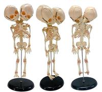 MYUYEE Multi Functions Skeleton Model Anatomical Double Head Fetal Skeleton Anatomy Model 37cm/14.5inch Semi-Flexible PVC Skeleton Model for Anatomy and Physiology