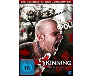 N - Skinning - Wir sind das Gesetz