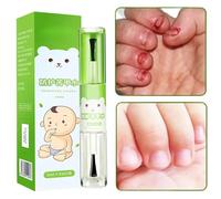 Nail Biting Prevention,Safe No Bite Water for Kids - 10ml Protective Effect Thumb Sucking Prevention for Home Kindergarten Traveling Outdoor Indoor