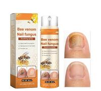 Nail Fungus Relief Strengthener Effectively repairs and treats Moisturising care spray Suitable as a gift for elderly people and friends with nail problems (1 pcs)