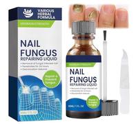 Nail Fungus Treatment for Toenail,Fungal Nail Treatment Extra Strong Toenail Fungus Treatment Nail Repair Growth Treatment Nail Softener for Thick Toenails Toe and Finger Nail Solution 30ML