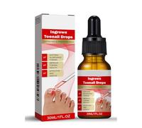 Nail Repair Essence,Fungel Nail Treatmet, Extra Strong Nail Fungas Treatmet for Toenail & Nail, Nourishing, Repairing Toenail,Nail Repair for Thick Nails, Cracked Nails, Damage Nails, 30ml