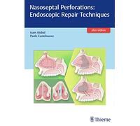 Nasoseptal Perforations: Endoscopic Repair Techniques