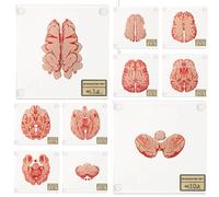 natalieenati (10pieces) Anatomic Brain Specimen Coasters-Neuroscience Gifts-Funny Coasters Gifts-Human Anatomy Gifts-Medical Student Gifts- Brain Decor（Acrylic）