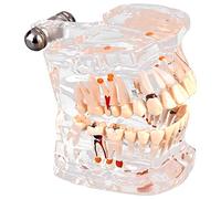 Natudeco Standard Teeth Model Adult Standard Transparent Demonstration Tooth Model Brushing Dental Floss Practice Dental Model Oral Pathological Model for School Teaching Research
