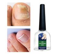 Natural Cracks Nail Strengthener - 11ml Nail Care Solution | Hyaluronic Acid Vìțamìns Proteins Minerals | Deep Moisturizing Fingernail Repair, Strengthening Liquid for Women Girls Teens Family