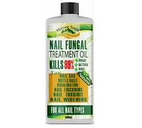 Nature Shine Nail Fungal Treatment Oil Toenails Extra Strong Anti Fungus Nail Repair, Golden,100 ml (Pack of 1)