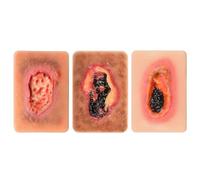 Necrosis Wound Model for Education, 3 Types of Necrotic Tissue - Wet Necrosis Type A, Dry Necrotic Type B/C, Teaching Explanation Model for Wound Care