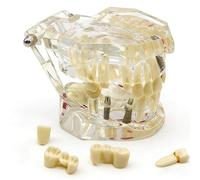 Neural Repair Dental Model,Removable Teeth Educational Model for Dentist School Anatomical,Transparent Teach Pathology Models,Demonstration Teaching Aid for Education(White)