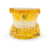 Neural Repair Dental Model,Removable Teeth Educational Model for Dentist School Anatomical,Transparent Teach Pathology Models,Demonstration Teaching Aid for Education(yellow)