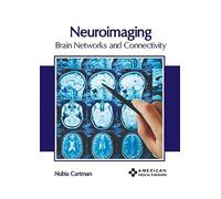 Neuroimaging: Brain Networks and Connectivity