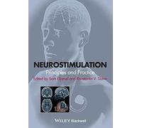 Neurostimulation: Principles and Practice
