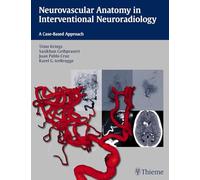 Neurovascular Anatomy in Interventional Neuroradiology: A Case-Based Approach