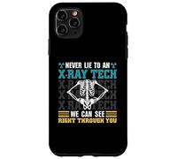 Never Lie To An X-Ray Tech - Radiology Technician Case for iPhone 11 Pro Max