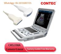 New Color Doppler Ultrasound Scanner Laptop Machine USG Diagnostic Convex+Linear