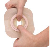 New Image FormaFlex Moldable Extended Wear Ostomy Barrier Adhesive Ta