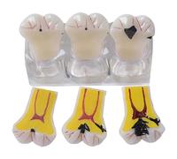 NGARY Removable Dental Teeth Model, Dental Caries Evolution Model Tooth Pathology Display Model, 4 Times Caries Teeth Disassembling Model, Three-Stage Tooth Decay Display, for Dentists, Patients,