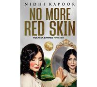 No More Red Skin: Rosacea Banned Forever