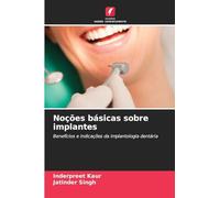 Noções básicas sobre implantes: Benefícios e indicações da implantologia dentária