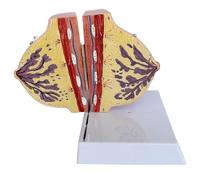 Non-lactating Breast Model, Human Breast Anatomy Model, Breast Sagittal Section Anatomical Display Model, for Breast Surgeon Scientific Education