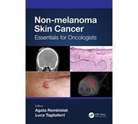 Non-melanoma Skin Cancer: Essentials for Oncologists