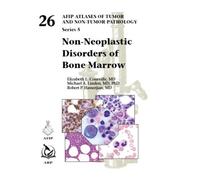 Non-Neoplastic Disorders of Bone Marrow