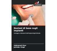 Nozioni di base sugli impianti: Vantaggi e indicazioni dell'implantologia dentale
