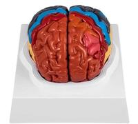 NSXAYIWE 2X Life Size Human Brain Anatomical Model, 2 Parts Brain Model with Figures 9 Colors for Science Classroom Study & Display Medical Model
