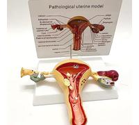 NVYAZJ Female Reproductive System Pathological Model, Simulation Human Body Uterus Ovary Vaginal Anatomy, Female Organs Model for Obstetrical Teaching Aids, Educational Tool