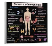 NWPNLXEA Healthy Bones Guide Poster - Chart on Osteoporosis Risk Factors & Prevention, Wellness Decor for Clinic & Study(Unframed,12x18inch(30x45cm))