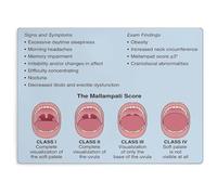 NWPNLXEA OSA and Mallampati Classification Educational Poster Obstructive Sleep Apnea Screening Chart School Study Aid Unframed,12x18inch(30x45cm)