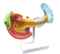 NZPOST Human Organ Anatomical Model Lesioned Pancreas Spleen Liver and Gallbladder Model for Digestive Pathology Teaching
