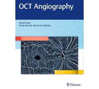 OCT Angiography by David Chow - 9781626234734