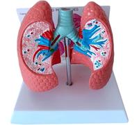 oiakus Lung Pathologies Anatomical Model, Human Bronchopulmonary Model, Human Organ Anatomy Model Lung Disease Model, Respiratory Lung Healthy Lung and Pathology