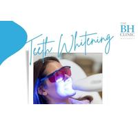One Hour Laser Teeth Whitening with Consultation