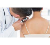One mole wart or skin tag removal session