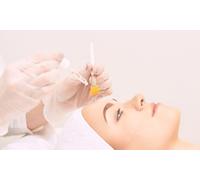 One Session: Chemical Peel
