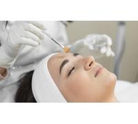 One Session of Advanced Chemical Peel Facial